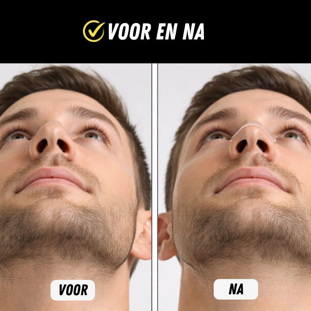 Better Breath Neusstrips, 100 Stuks, Voor en na