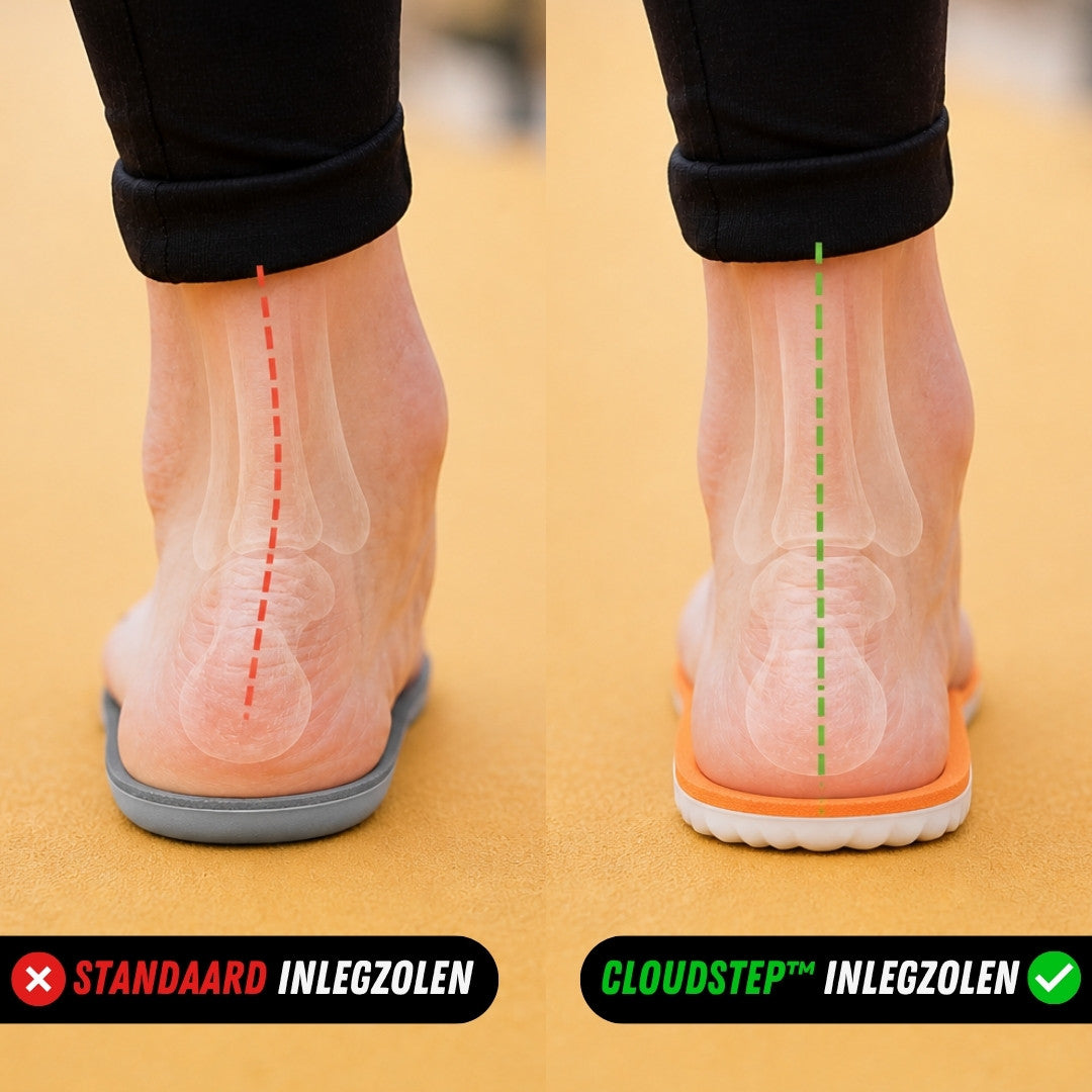 CloudStep Inlegzolen, Premium Steunzolen, Productpagina, Voor en na
