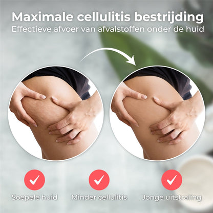 Elekstrische Cupper, Cellulitis Massage Apparaat, Voordelen