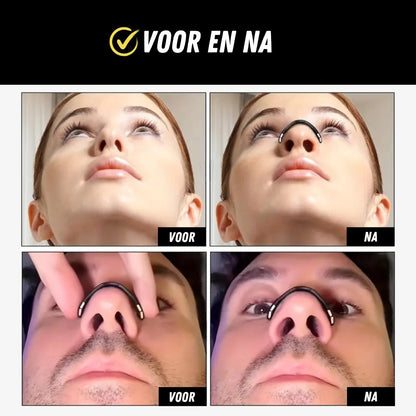 Magnetische Neusstrip, Neusspreider voor meer Zuurstof, voor en na
