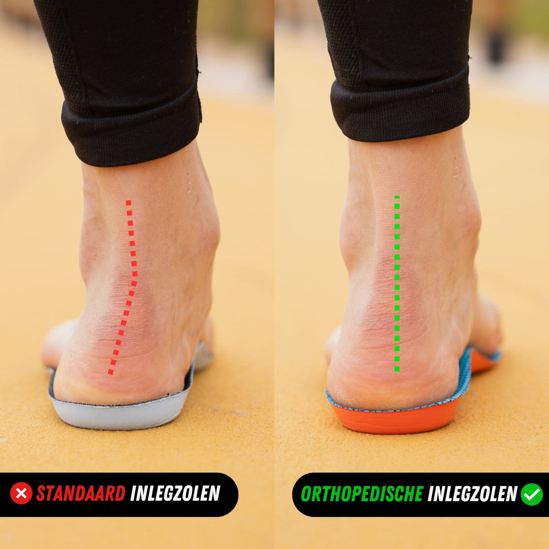 Orthopedische Inlegzolen, Steunzolen voor Hielspoor, Productpagina, Voor en na
