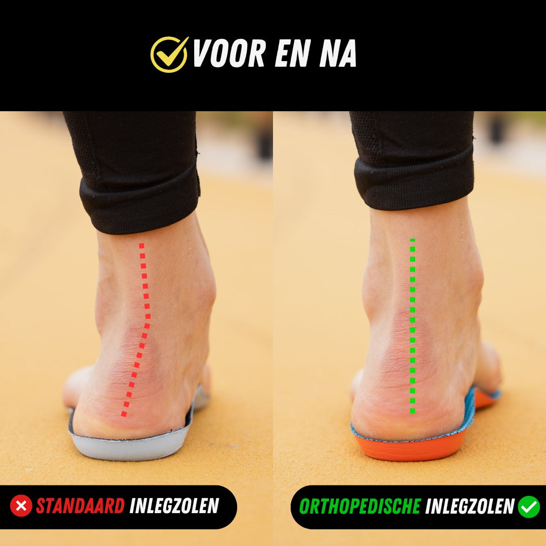 Orthopedische Inlegzolen, Steunzolen voor Hielspoor, Voor en na