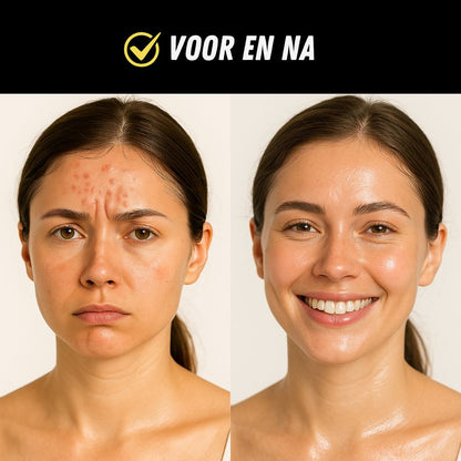 Rood Lichttherapie Masker, LED Gezichtsmasker Klachten, Voor en Na