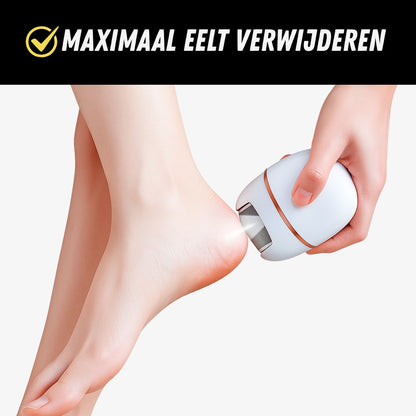 SmartCare Eelt Verwijderaar, Elektrische Voetvijl, Eelt verwijderen