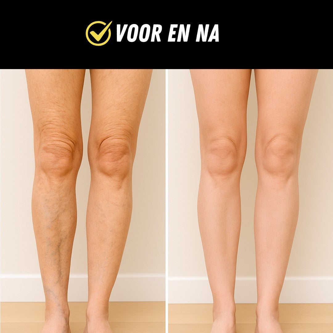 SmartCare Voetmassage Apparaat, EMS Spierstimulator, Voor en Na