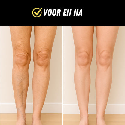 SmartCare Voetmassage Apparaat, EMS Spierstimulator, Voor en Na